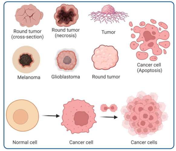 Cancer cells